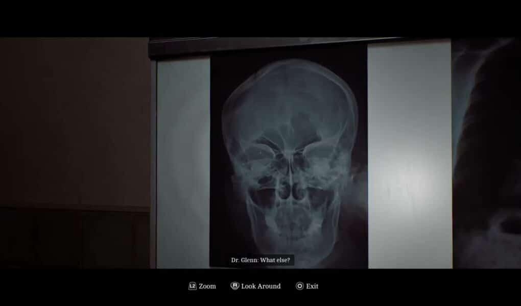Silent Hill: Townfall – Part 3 The Patient: Place and Examine The Head and Chest X Rays with Glenn