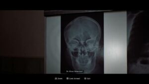 Silent Hill: Townfall – Part 3 The Patient: Place and Examine The Head and Chest X Rays with Glenn
