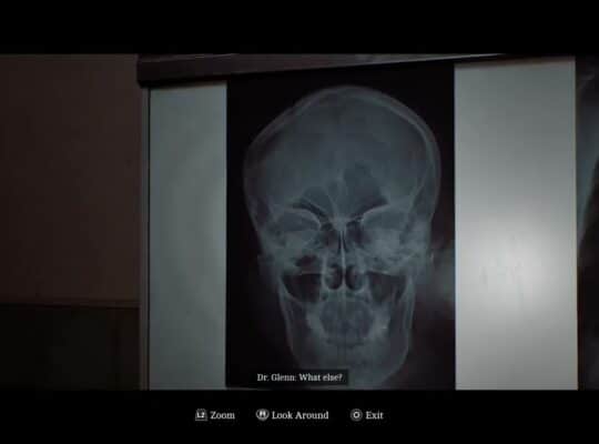 Silent Hill: Townfall – Part 3 The Patient: Place and Examine The Head and Chest X Rays with Glenn